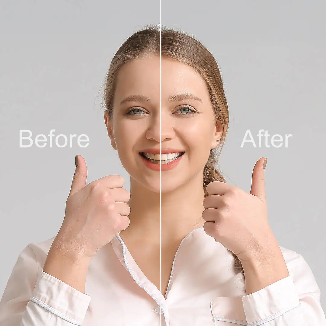 Smile makeover planning at Refined Smiles